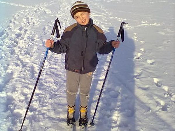 В Шахтах 11-летний мальчик получил ожоги 1, 2 и 3 степени, облив себя бензином