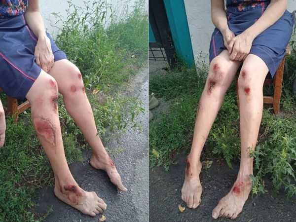 В Шахтах возбудили уголовное дело по факту травмирования пассажирки в автобусе