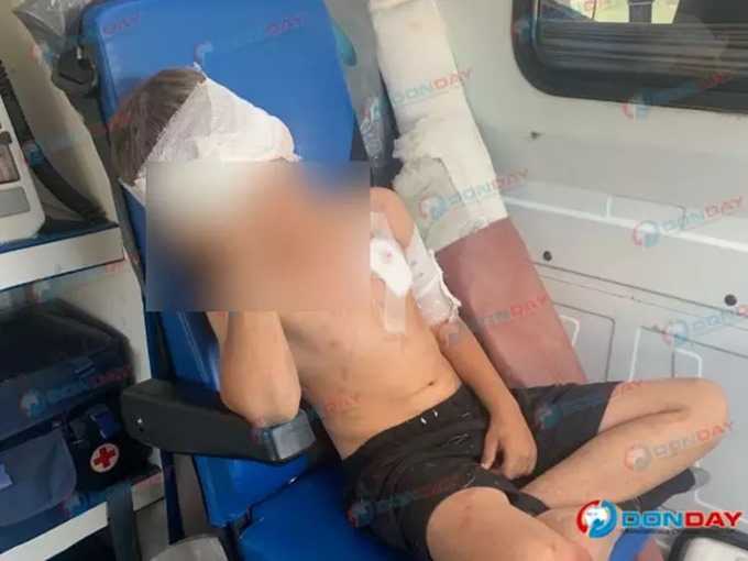 Мальчика искусал домашний волк: врачи города Шахты оказали ему первую помощь