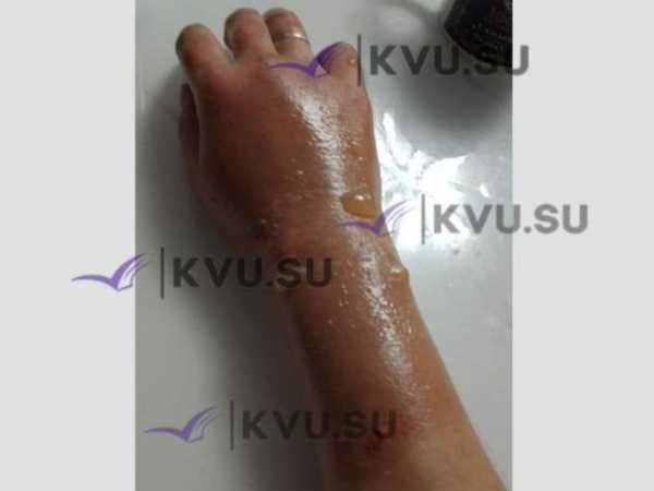 Семья из Шахт потеряла дом из-за пожара